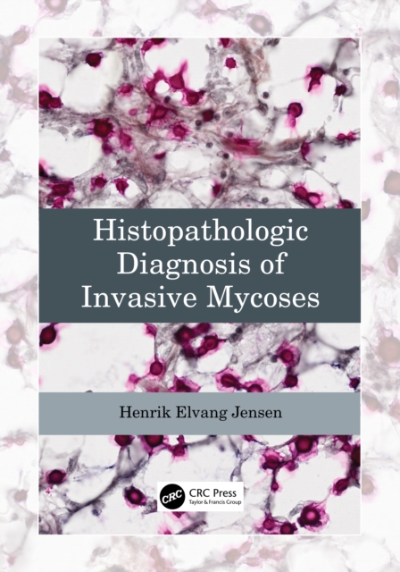 Histopathologic Diagnosis of Invasive Mycoses, Paperback / softback Book