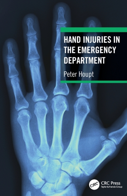 Hand Injuries in the Emergency Department, Paperback / softback Book