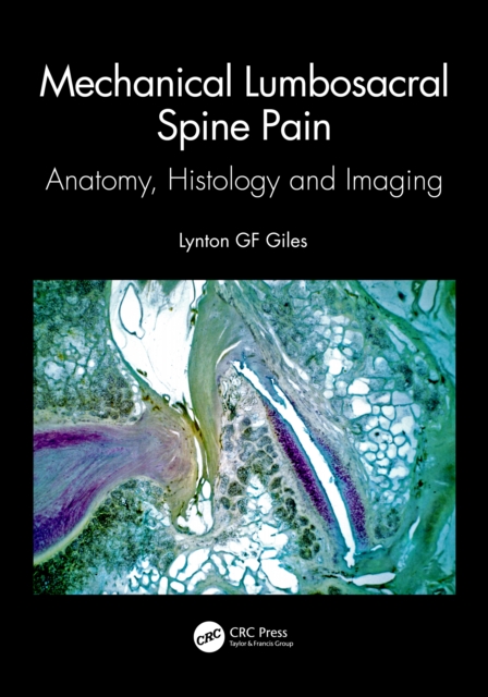 Mechanical Lumbosacral Spine Pain : Anatomy, Histology and Imaging, Paperback / softback Book