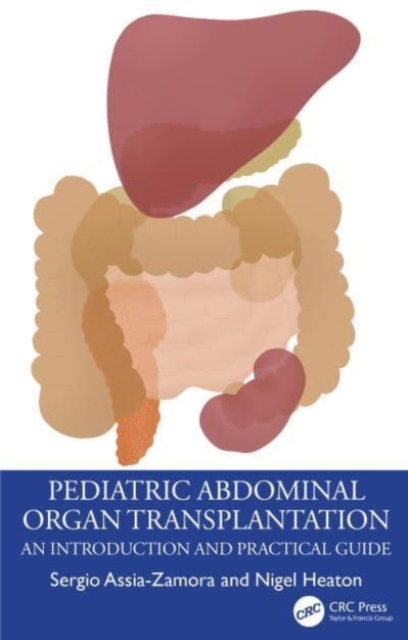Pediatric Abdominal Organ Transplantation : An Introduction and Practical guide, Paperback / softback Book
