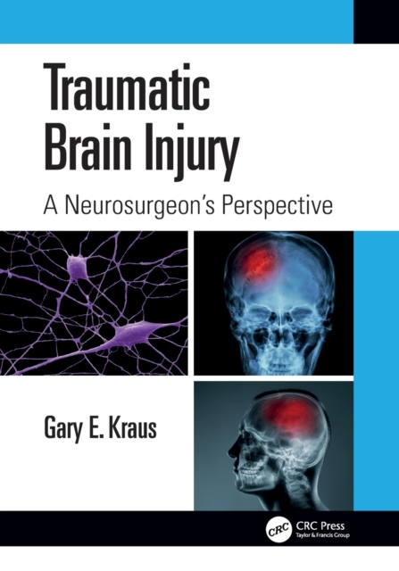 Traumatic Brain Injury: A Neurosurgeon's Perspective, Paperback / softback Book