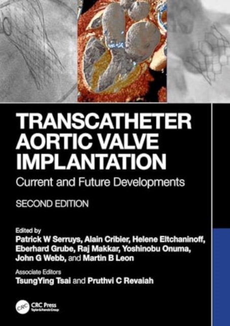 Transcatheter Aortic Valve Implantation : Current and Future Developments, Hardback Book