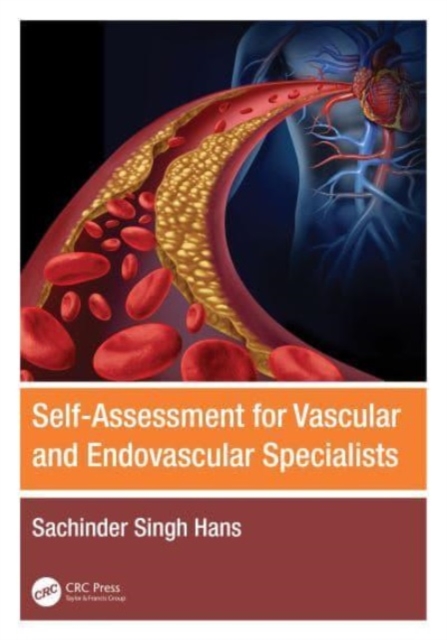 Self-Assessment for Vascular and Endovascular Specialists, Paperback / softback Book