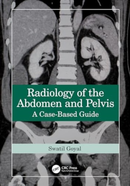 Radiology of the Abdomen and Pelvis : A Case-Based Guide, Paperback / softback Book