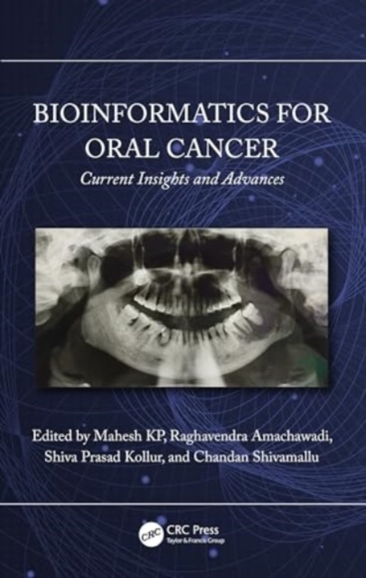 Bioinformatics for Oral Cancer : Current Insights and Advances, Hardback Book
