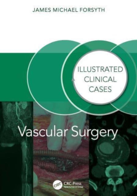 Vascular Surgery: : Illustrated Clinical Cases, Paperback / softback Book