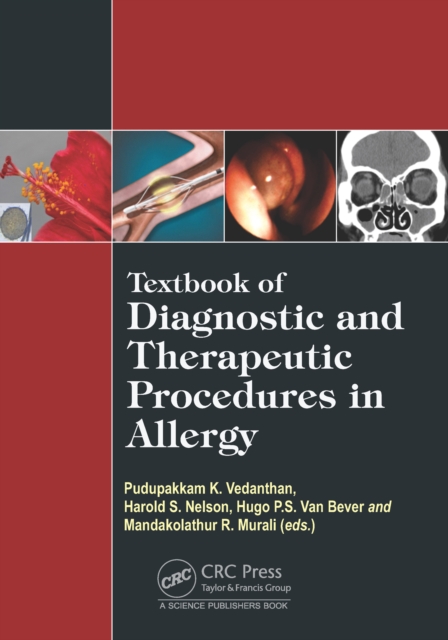 Textbook of Diagnostic and Therapeutic Procedures in Allergy, PDF eBook