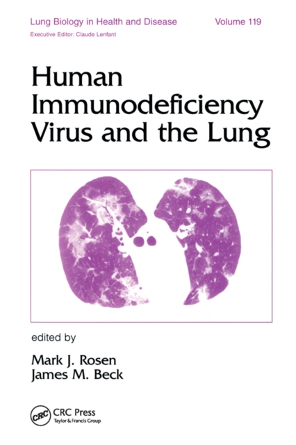 Jj Rosen Human Immunodeficiency Virus and the Lung: Mark J. Rosen: 9781040160589 ...