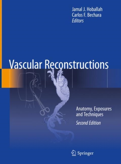 Vascular Reconstructions : Anatomy, Exposures and Techniques, Hardback Book