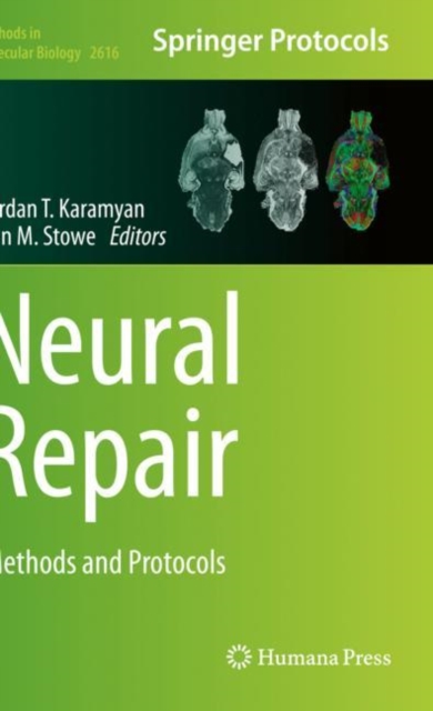Neural Repair : Methods and Protocols, Paperback / softback Book