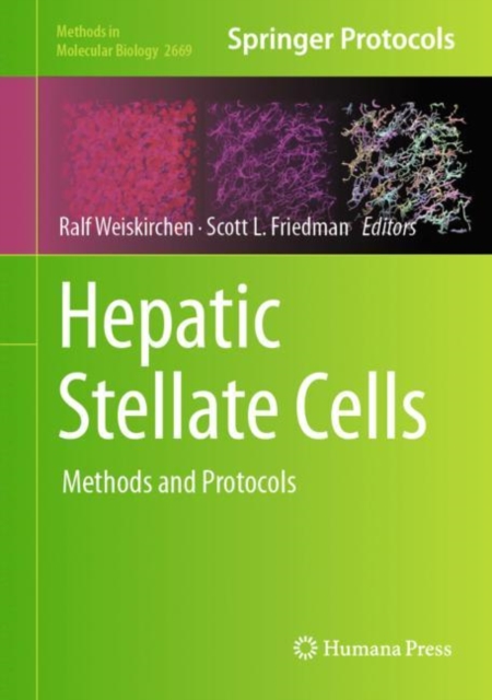 Hepatic Stellate Cells : Methods and Protocols, Hardback Book