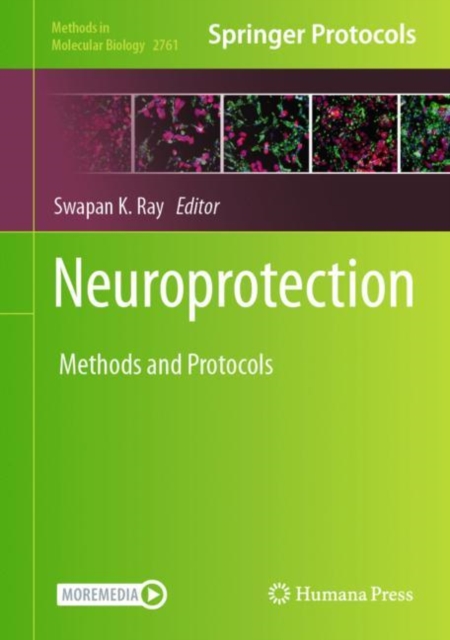 Neuroprotection : Method and Protocols, Hardback Book