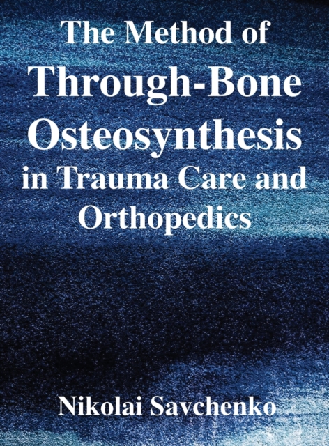 The Method of Through-Bone Osteosynthesis in Trauma Care and Orthopedics, Hardback Book