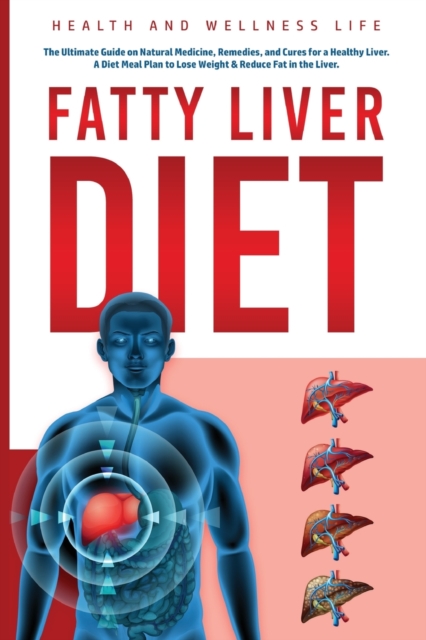 Fatty Liver Diet : The Ultimate Guide on Natural Medicine, Remedies, and Cures for a Healthy Liver. A Diet Meal Plan to Lose Weight & Reduce Fat in the Liver.: The Ultimate Guide on Natural Medicine,, Paperback / softback Book