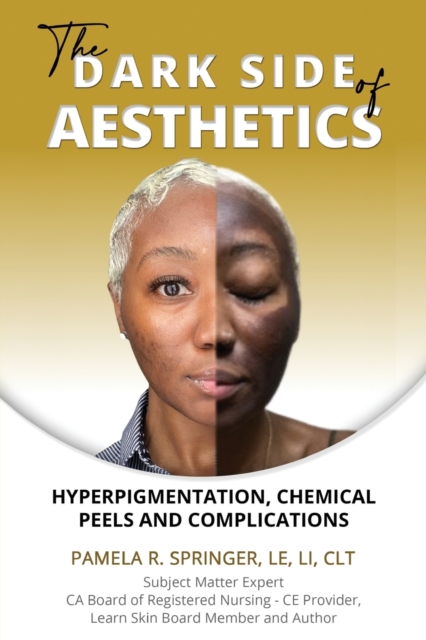 The Dark Side of Aesthetics : Hyperpigmentation, Chemical Peels, and Complications, Paperback / softback Book