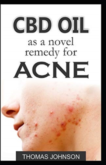 CBD Oil as a Novel Remedy for Acne, Paperback / softback Book