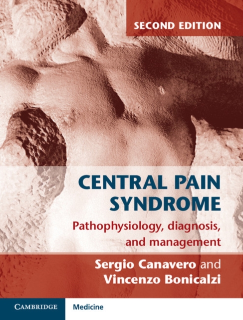 Central Pain Syndrome : Pathophysiology, Diagnosis and Management, Hardback Book