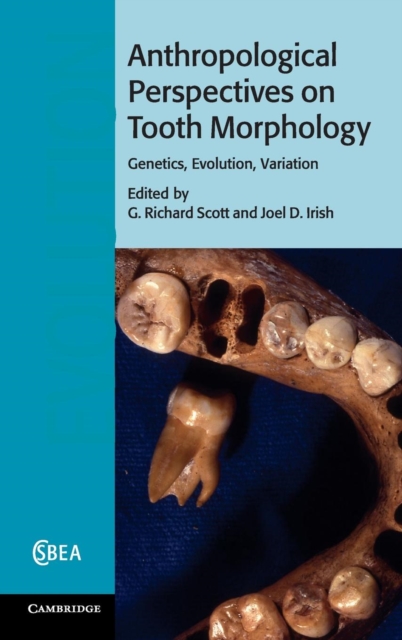 Anthropological Perspectives on Tooth Morphology : Genetics, Evolution, Variation, Hardback Book