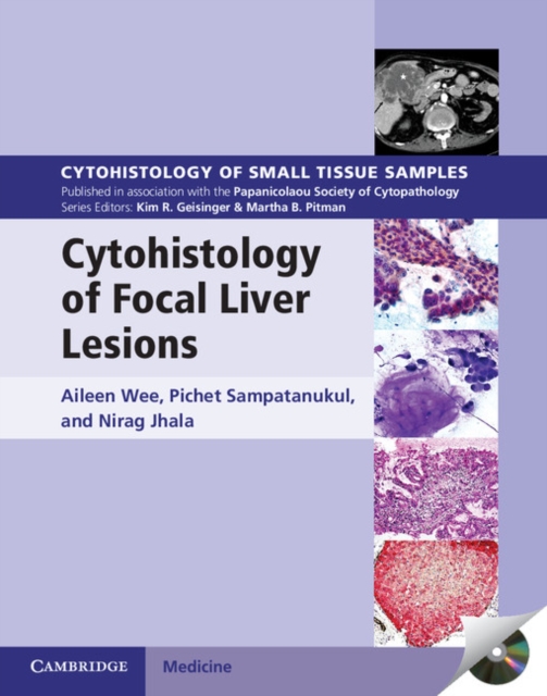 Cytohistology of Focal Liver Lesions, Multiple-component retail product, part(s) enclose Book