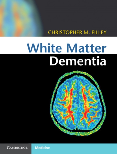 White Matter Dementia, Hardback Book