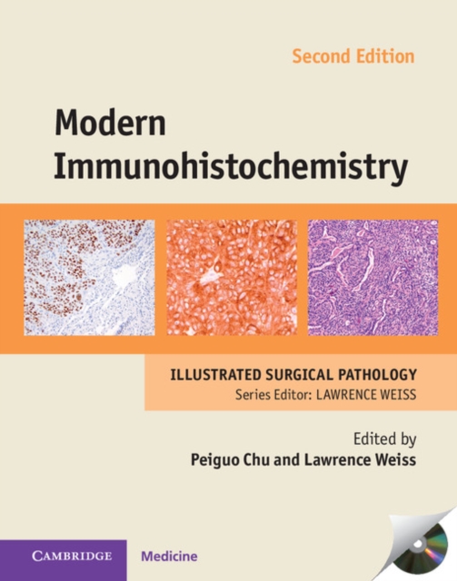 Modern Immunohistochemistry with DVD-ROM, Multiple-component retail product, part(s) enclose Book