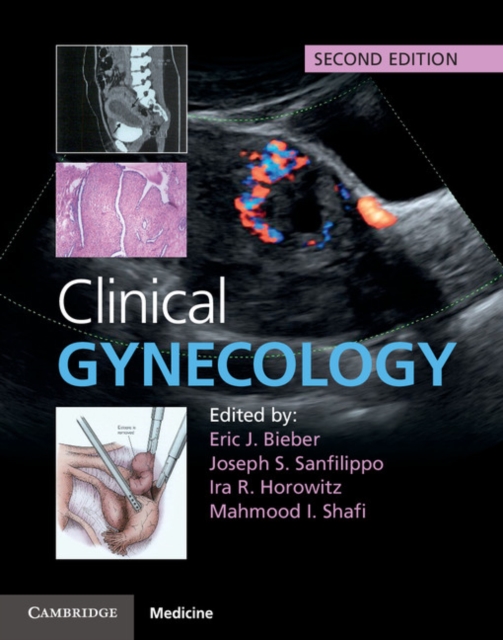 Clinical Gynecology, Hardback Book