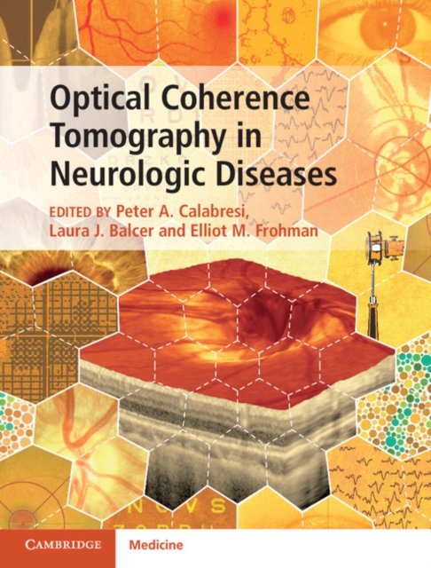 Optical Coherence Tomography in Neurologic Diseases, Hardback Book