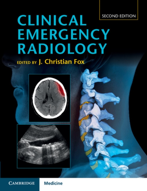 Clinical Emergency Radiology, Hardback Book