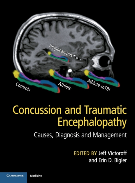 Concussion and Traumatic Encephalopathy : Causes, Diagnosis and Management, Hardback Book