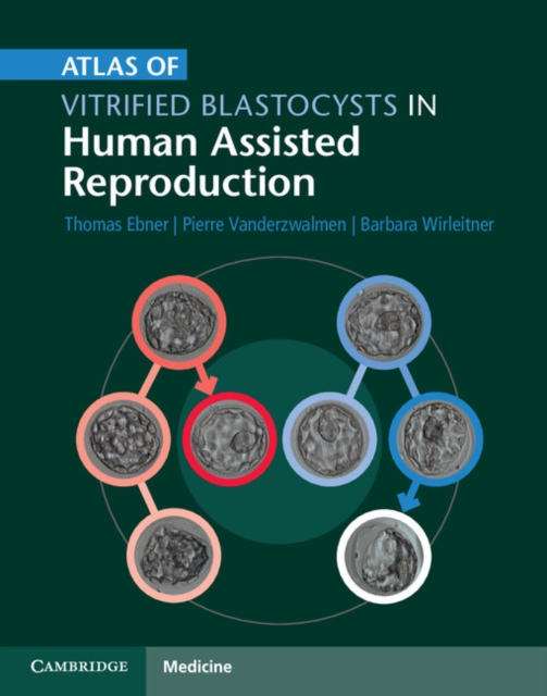 Atlas of Vitrified Blastocysts in Human Assisted Reproduction, Hardback Book