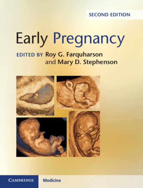 Early Pregnancy, Hardback Book