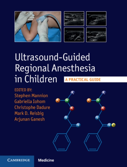Ultrasound-Guided Regional Anesthesia in Children : A Practical Guide, Hardback Book