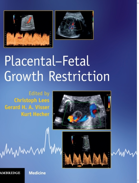 Placental-Fetal Growth Restriction, Hardback Book
