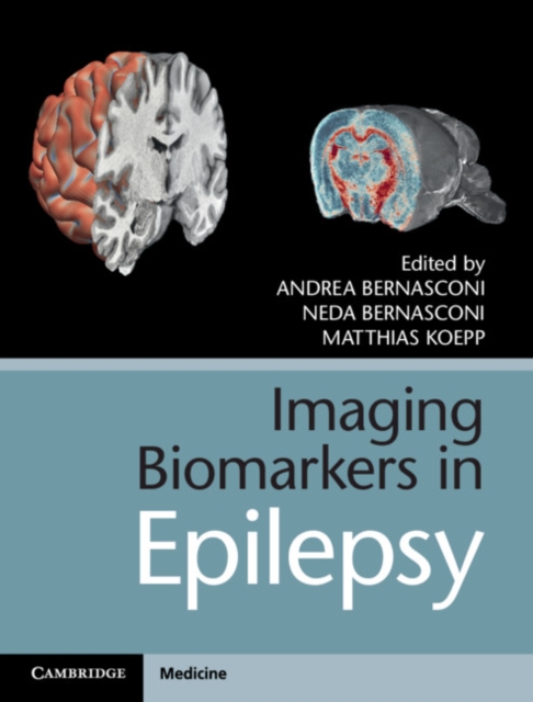 Imaging Biomarkers in Epilepsy, Hardback Book
