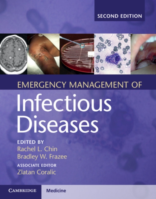 Emergency Management of Infectious Diseases, Hardback Book