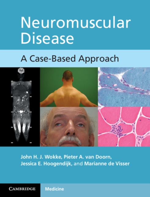 Neuromuscular Disease : A Case-Based Approach, PDF eBook
