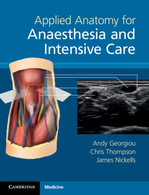 Applied Anatomy for Anaesthesia and Intensive Care, Paperback / softback Book