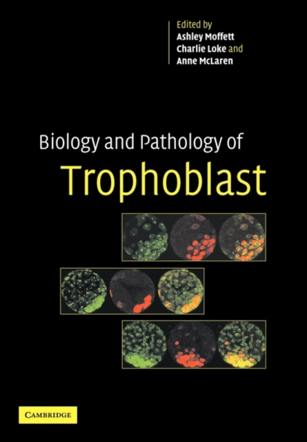 Biology and Pathology of Trophoblast, Paperback / softback Book