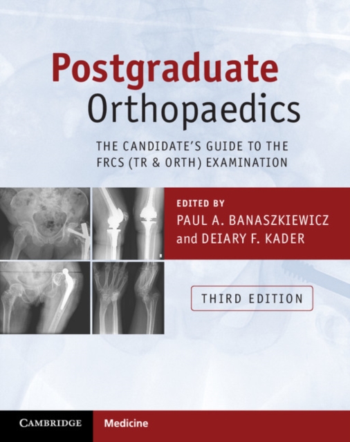 Postgraduate Orthopaedics : The Candidate's Guide to the FRCS (Tr & Orth) Examination, Paperback / softback Book