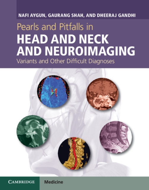 Pearls and Pitfalls in Head and Neck and Neuroimaging : Variants and Other Difficult Diagnoses, EPUB eBook