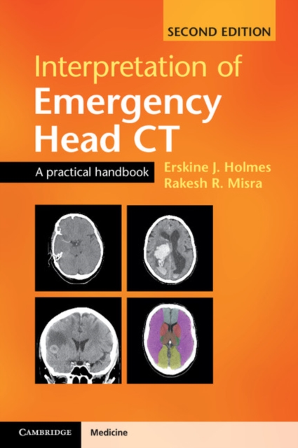 Interpretation of Emergency Head CT : A Practical Handbook, Paperback / softback Book