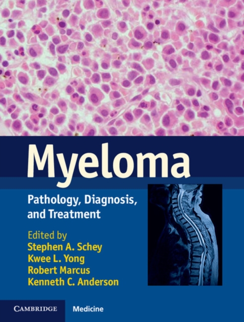 Myeloma : Pathology, Diagnosis, and Treatment, EPUB eBook