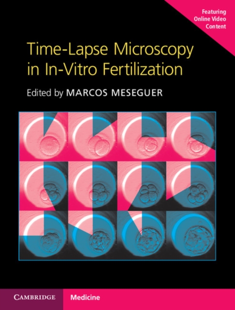 Time-Lapse Microscopy in In-Vitro Fertilization Hardback with Online Resource, Multiple-component retail product Book