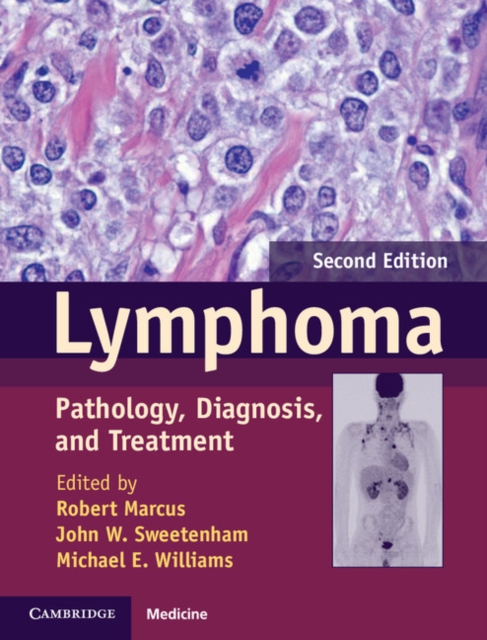 Lymphoma : Pathology, Diagnosis, and Treatment, PDF eBook