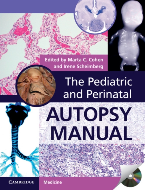 The Pediatric and Perinatal Autopsy Manual with DVD-ROM, Multiple-component retail product, part(s) enclose Book