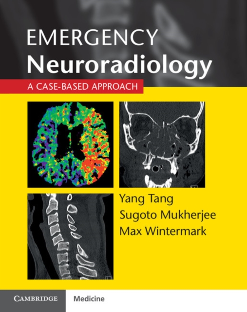 Emergency Neuroradiology : A Case-Based Approach, Paperback / softback Book