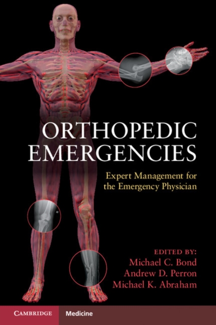 Orthopedic Emergencies : Expert Management for the Emergency Physician, EPUB eBook