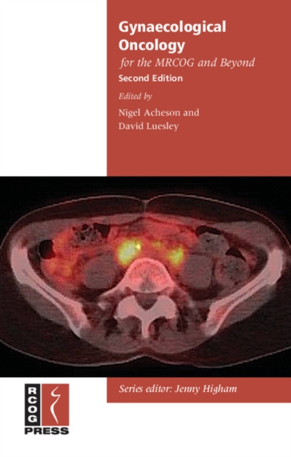 Gynaecological Oncology for the MRCOG and Beyond, PDF eBook