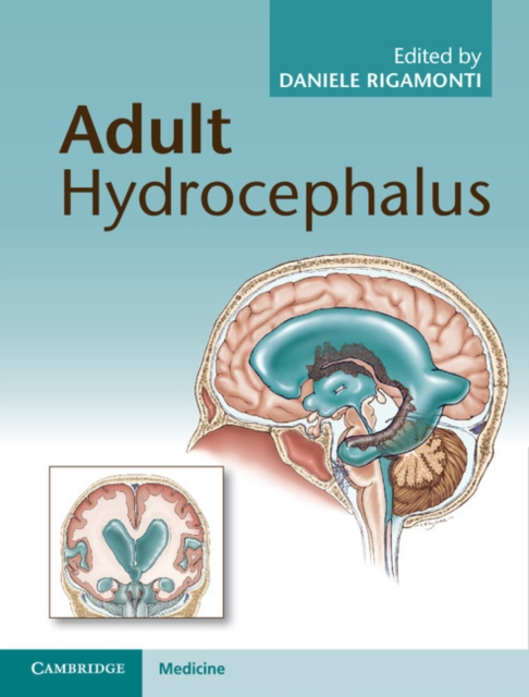 Adult Hydrocephalus, PDF eBook