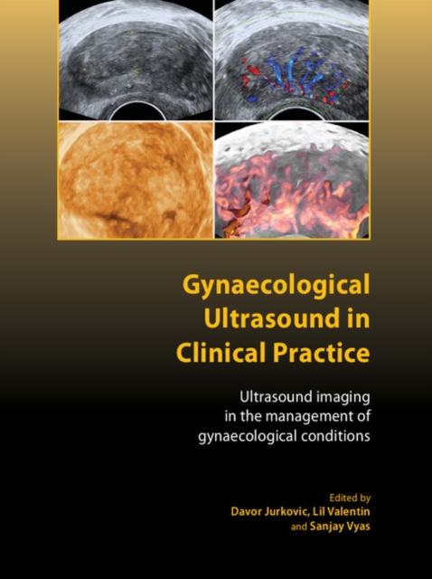 Gynaecological Ultrasound in Clinical Practice : Ultrasound Imaging in the Management of Gynaecological Conditions, PDF eBook